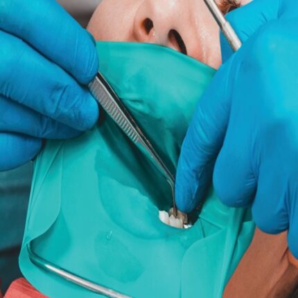 RUBBER DAM LASTİK ÖRTÜ